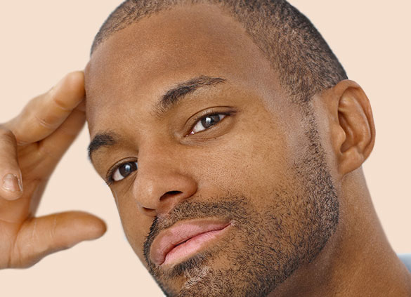 Ear Reshaping