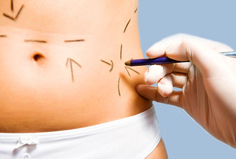 Plastic Surgery