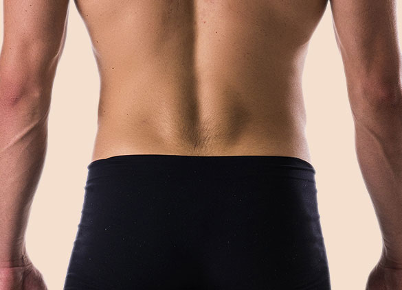 Liposuction in Richmond, VA at Skin Surgery Center of Virginia | Plastic Surgery Richmond